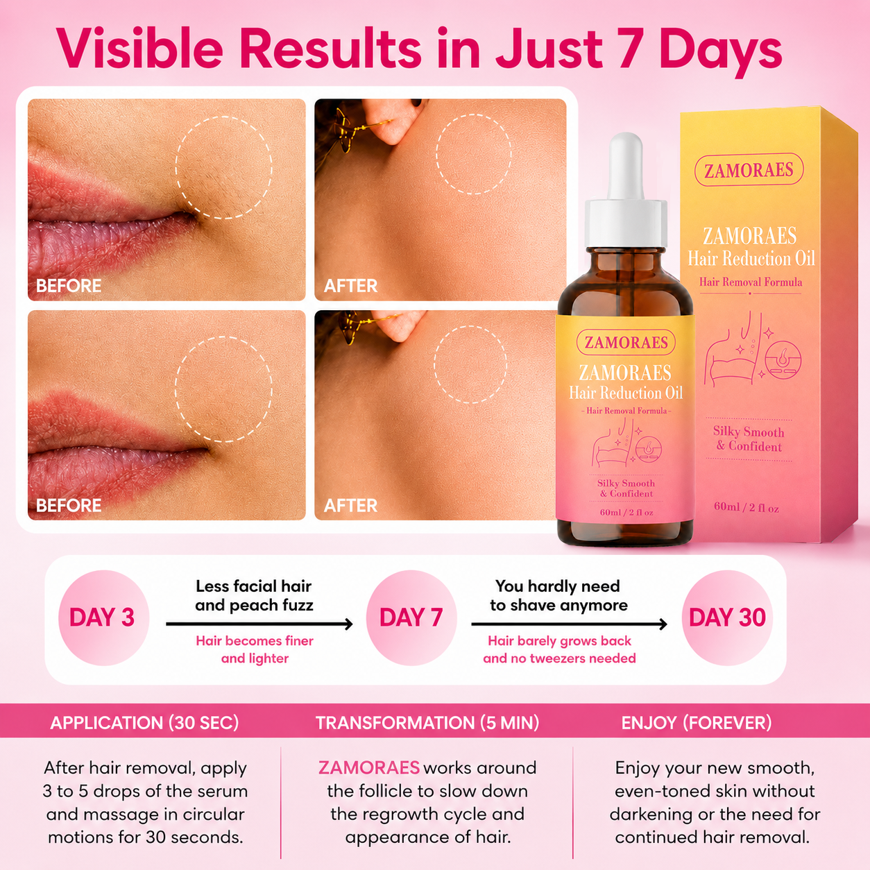 🔥LAST DAY 60% OFF ZAMORAES Hair Reduction Oil 60 ml – Permanent Hair Removal Oil