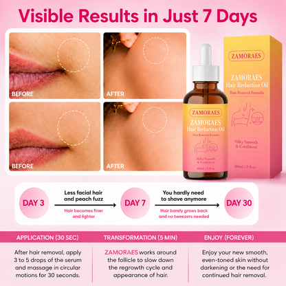 🔥LAST DAY 60% OFF ZAMORAES Hair Reduction Oil 60 ml – Permanent Hair Removal Oil