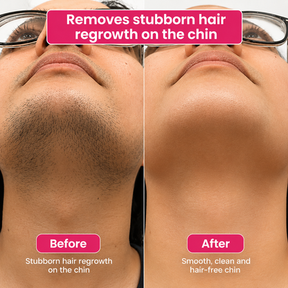 🔥LAST DAY 60% OFF ZAMORAES Hair Reduction Oil 60 ml – Permanent Hair Removal Oil