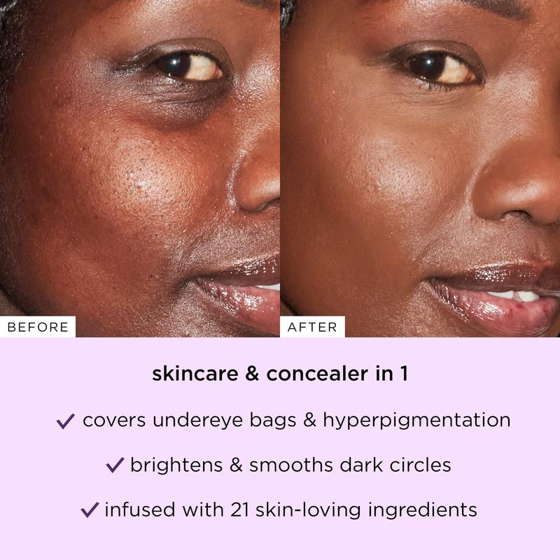 🌟ZAMORAES Dual-Action Concealer Stick: Instantly Hide Dark Circles & Puffiness