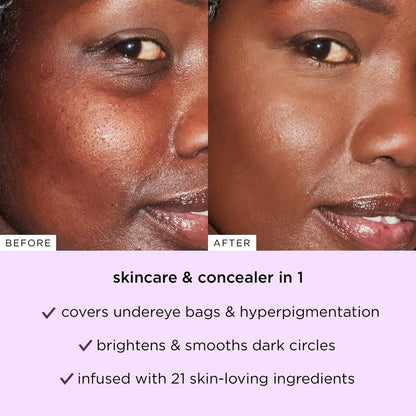 🌟ZAMORAES Dual-Action Concealer Stick: Instantly Hide Dark Circles & Puffiness